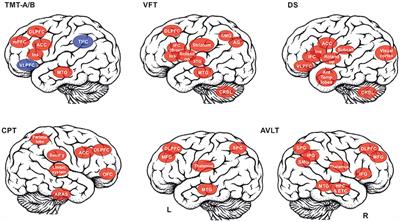 Theoretical Modeling of Cognitive Dysfunction in Schizophrenia by Means of Errors and Corresponding Brain Networks